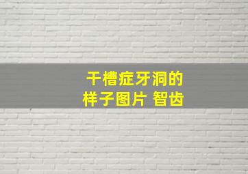 干槽症牙洞的样子图片 智齿